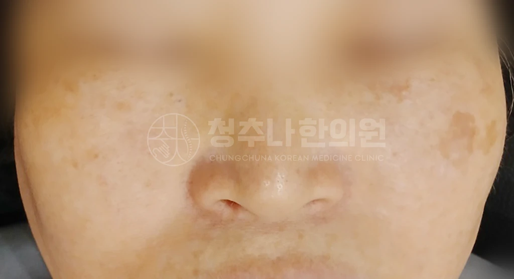 before_image