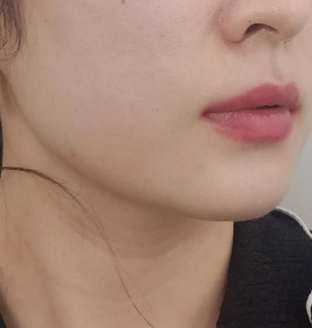 before_image