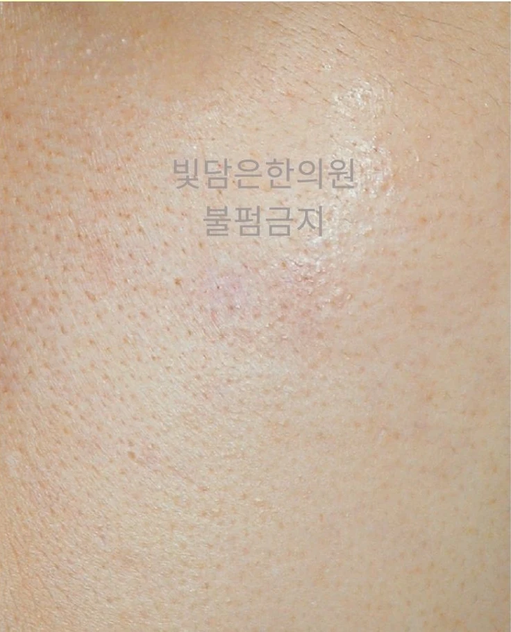before_image