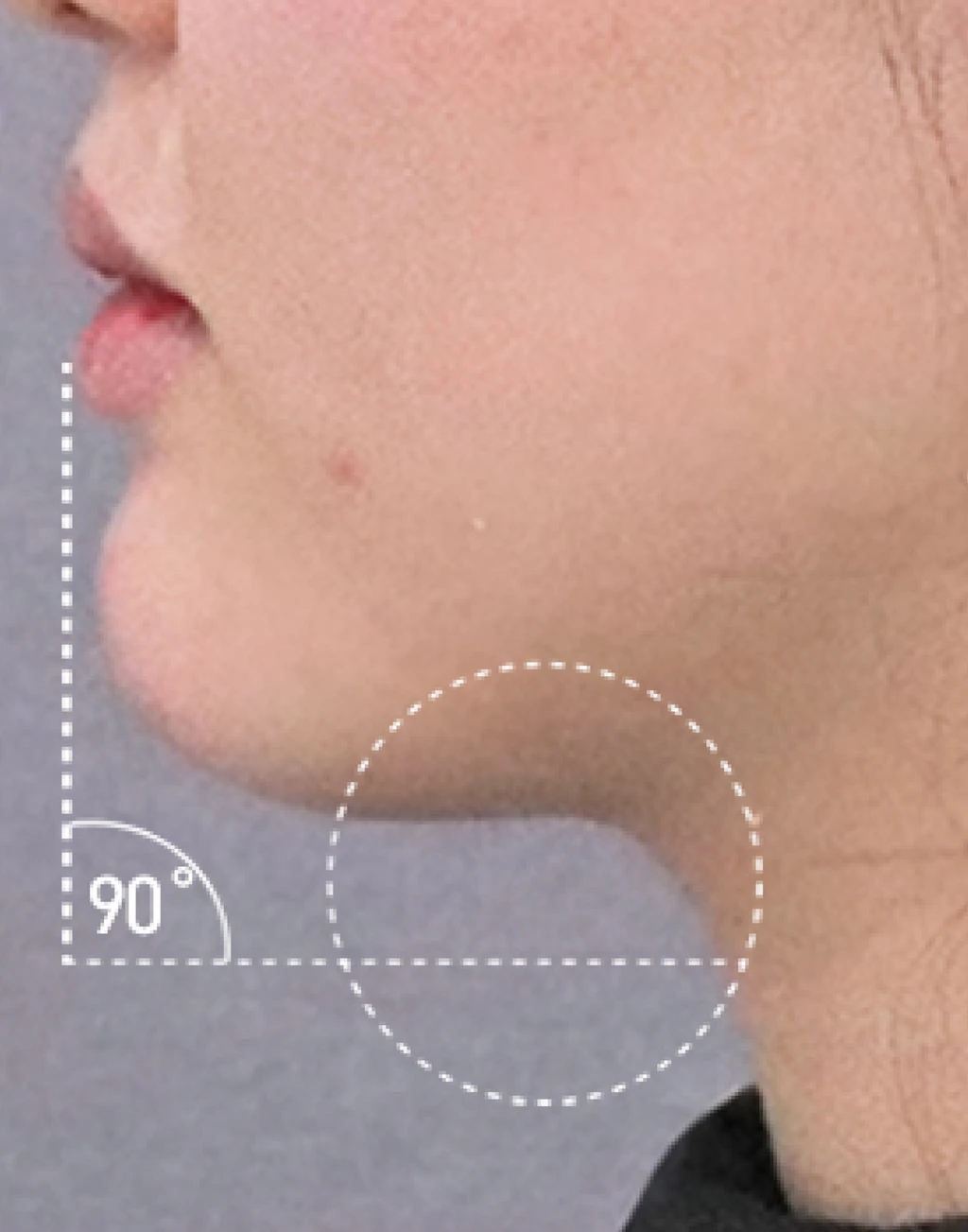 before_image