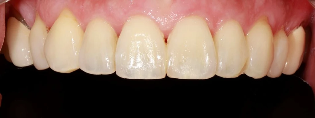 before_image