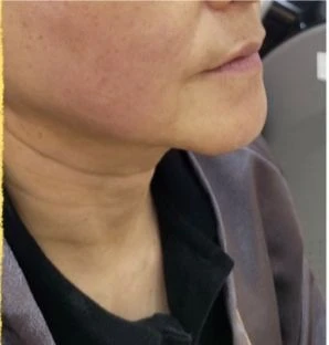 before_image