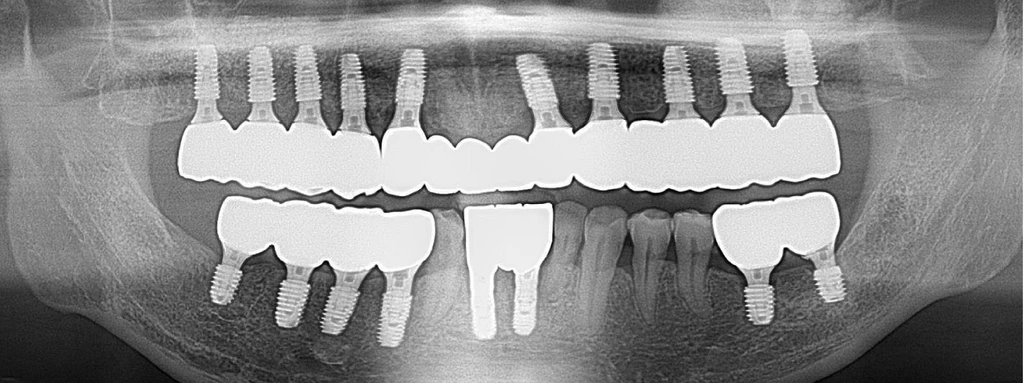 before_image