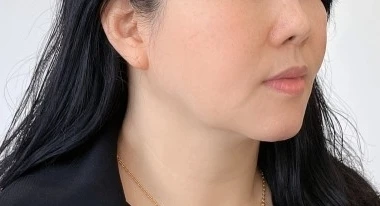 before_image