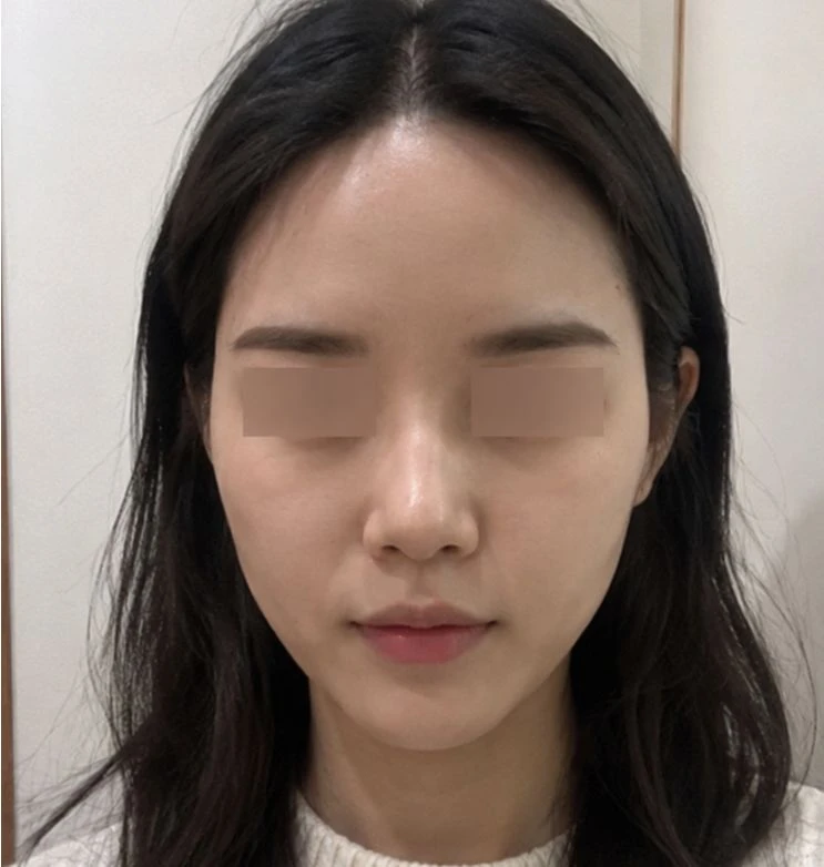 before_image