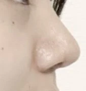 before_image