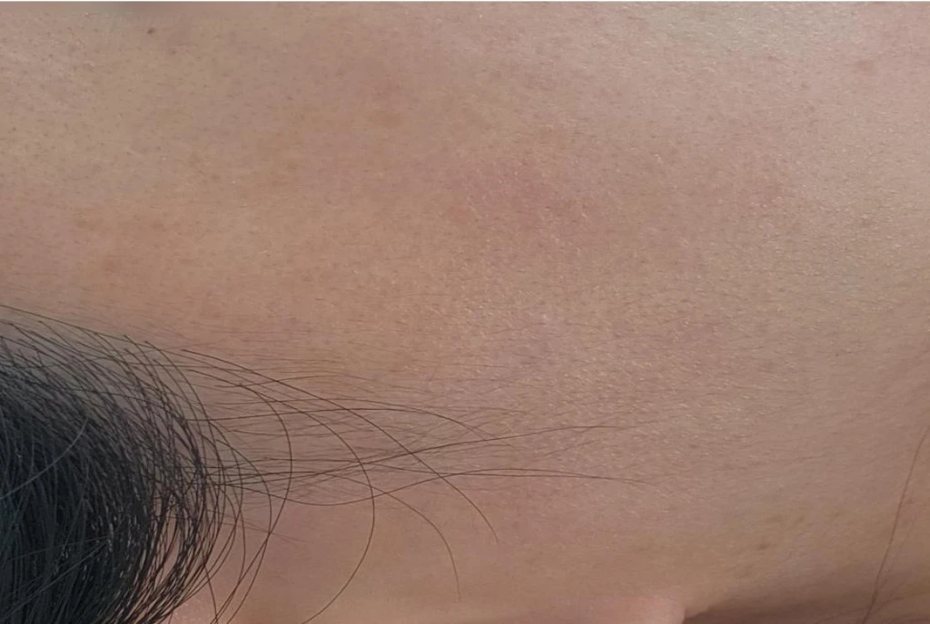 before_image