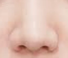 before_image