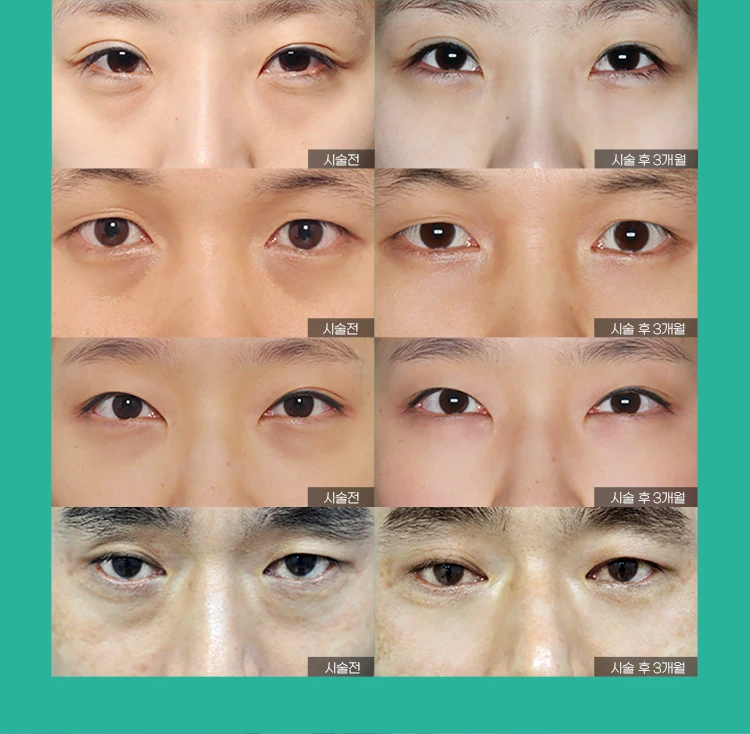 before_image