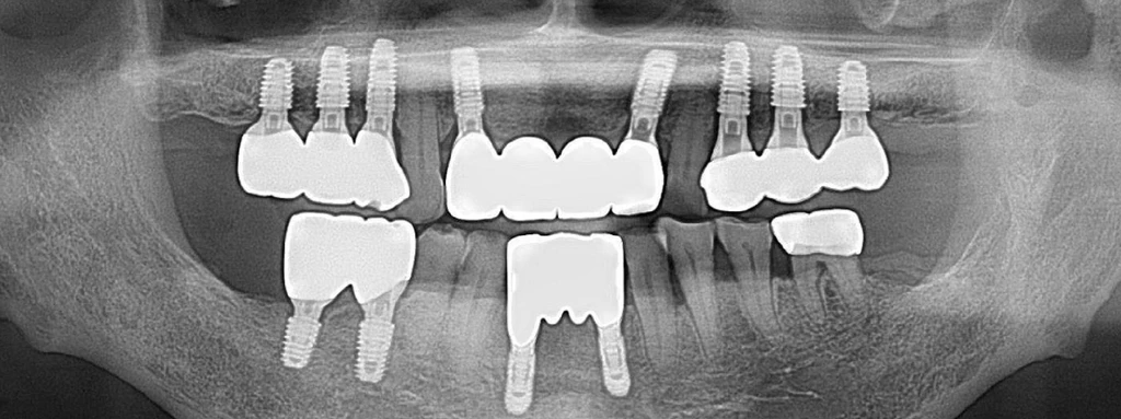 before_image
