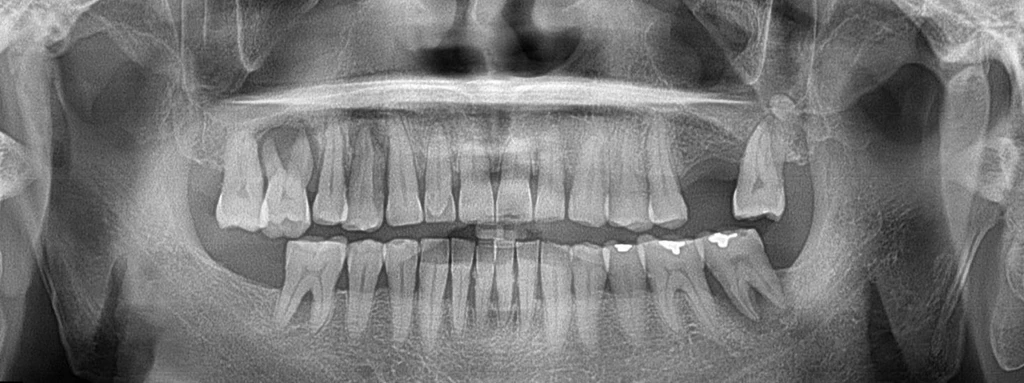 before_image