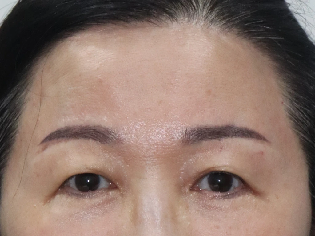 before_image