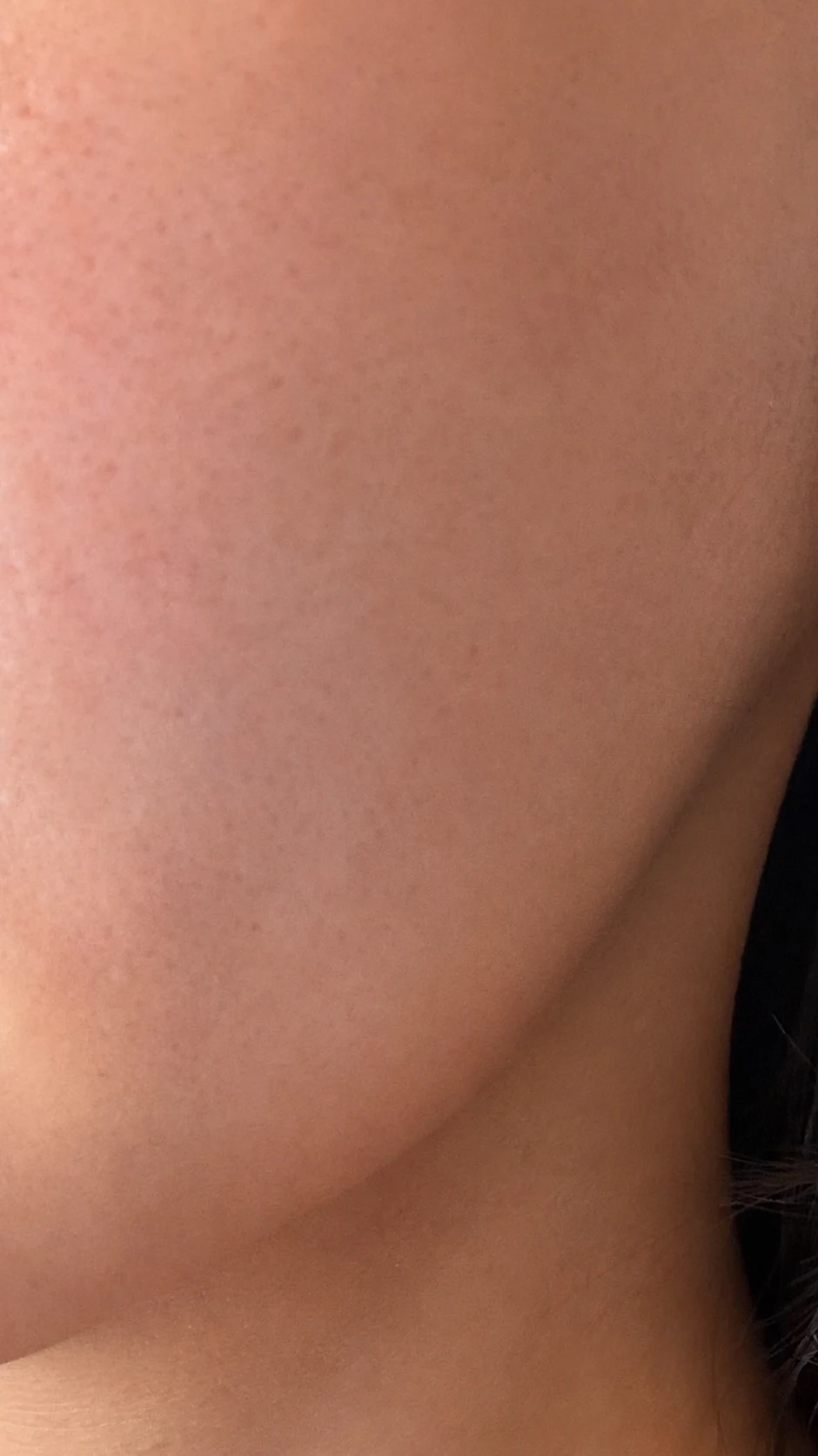 before_image