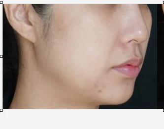 before_image