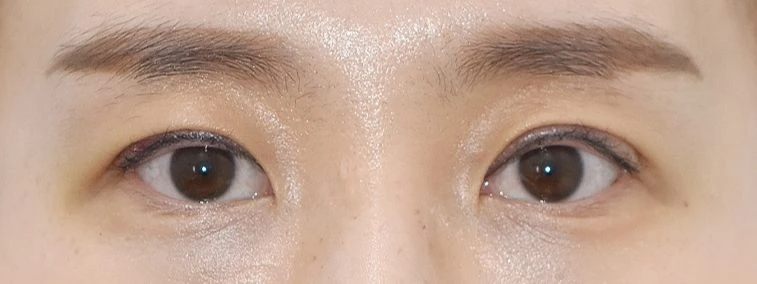 before_image