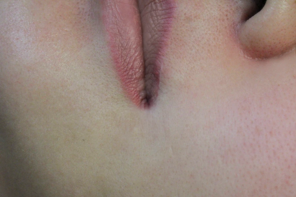 before_image