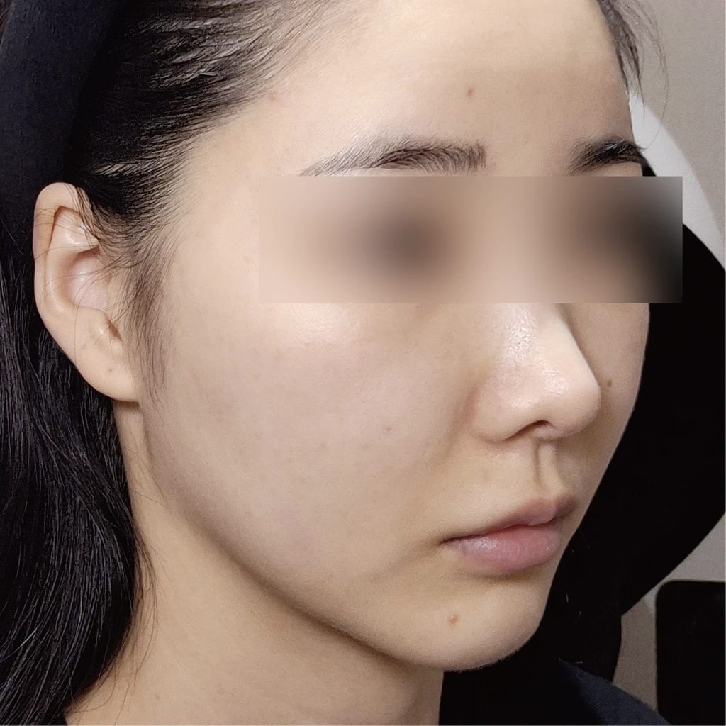 before_image