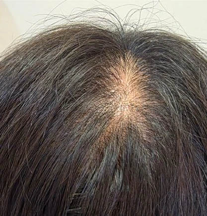before_image