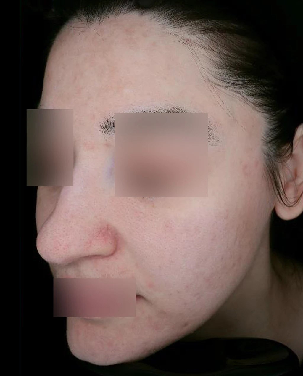 before_image
