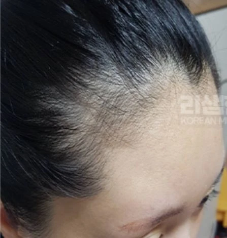before_image
