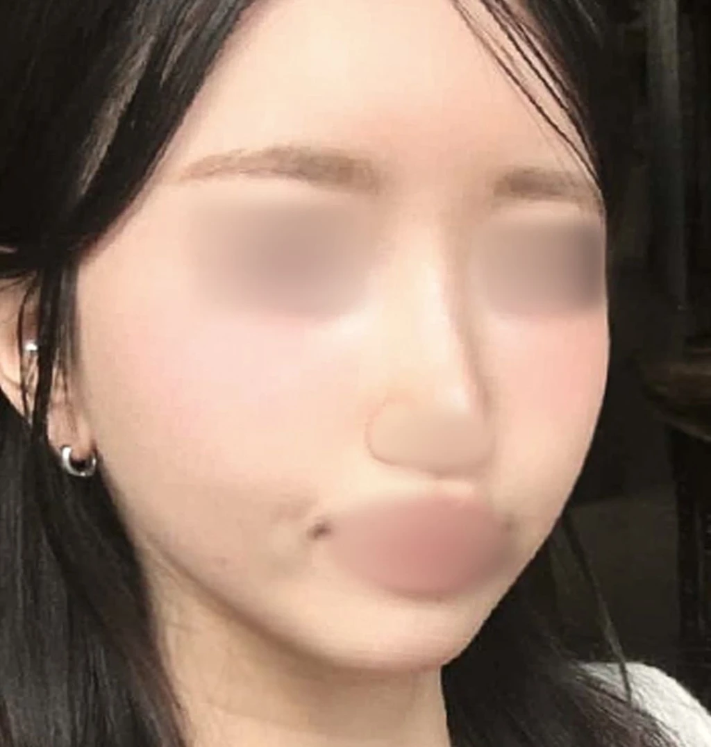before_image