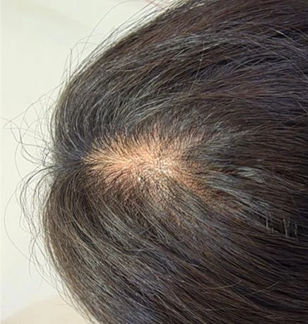 before_image
