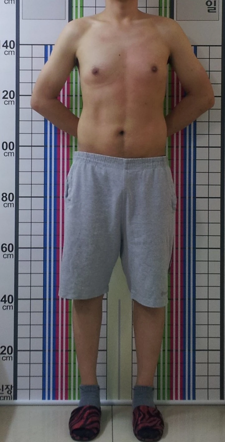 before_image