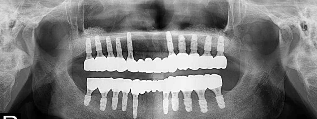 before_image