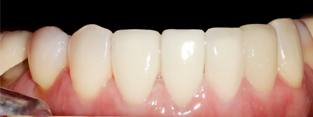 before_image