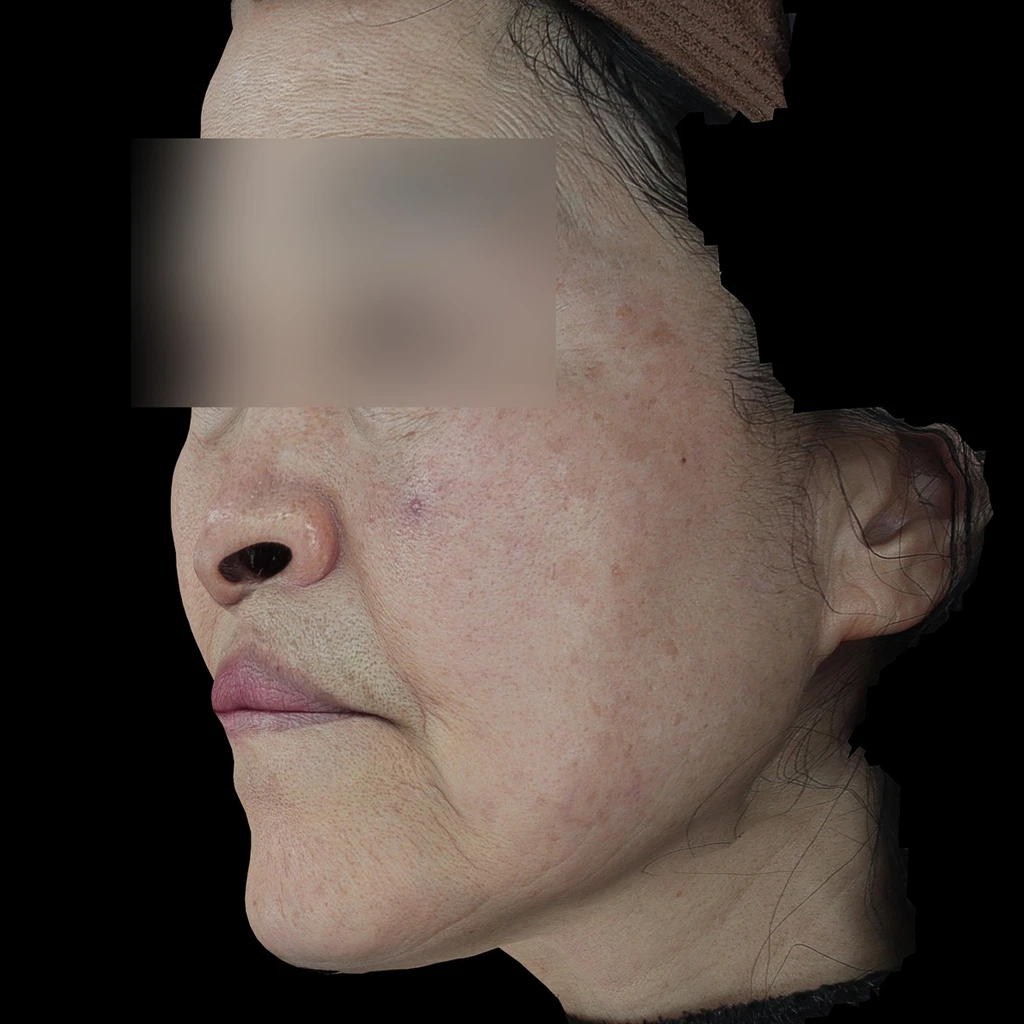 before_image