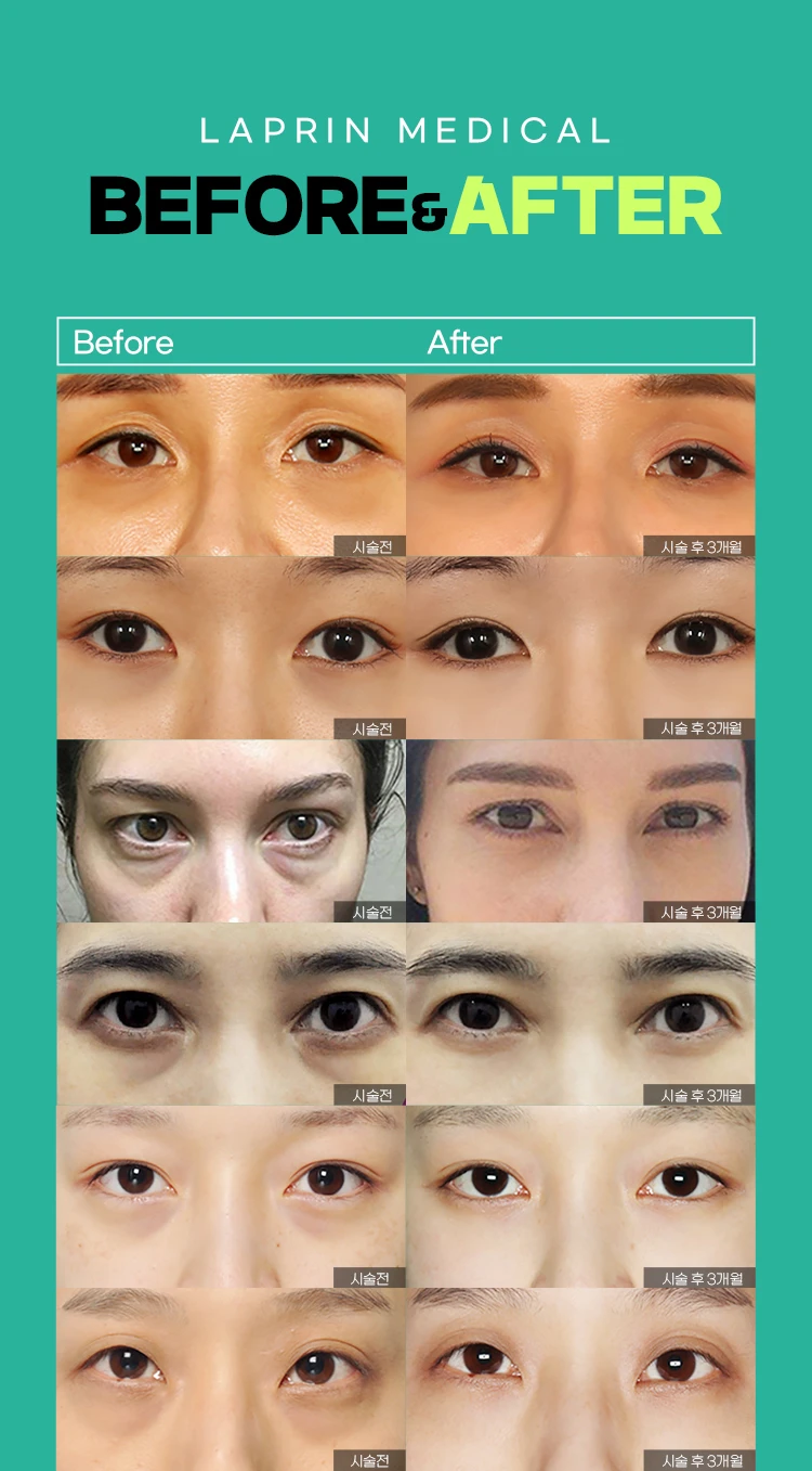 before_image