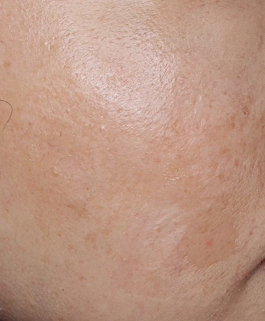 before_image