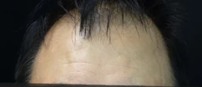 before_image