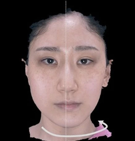 before_image