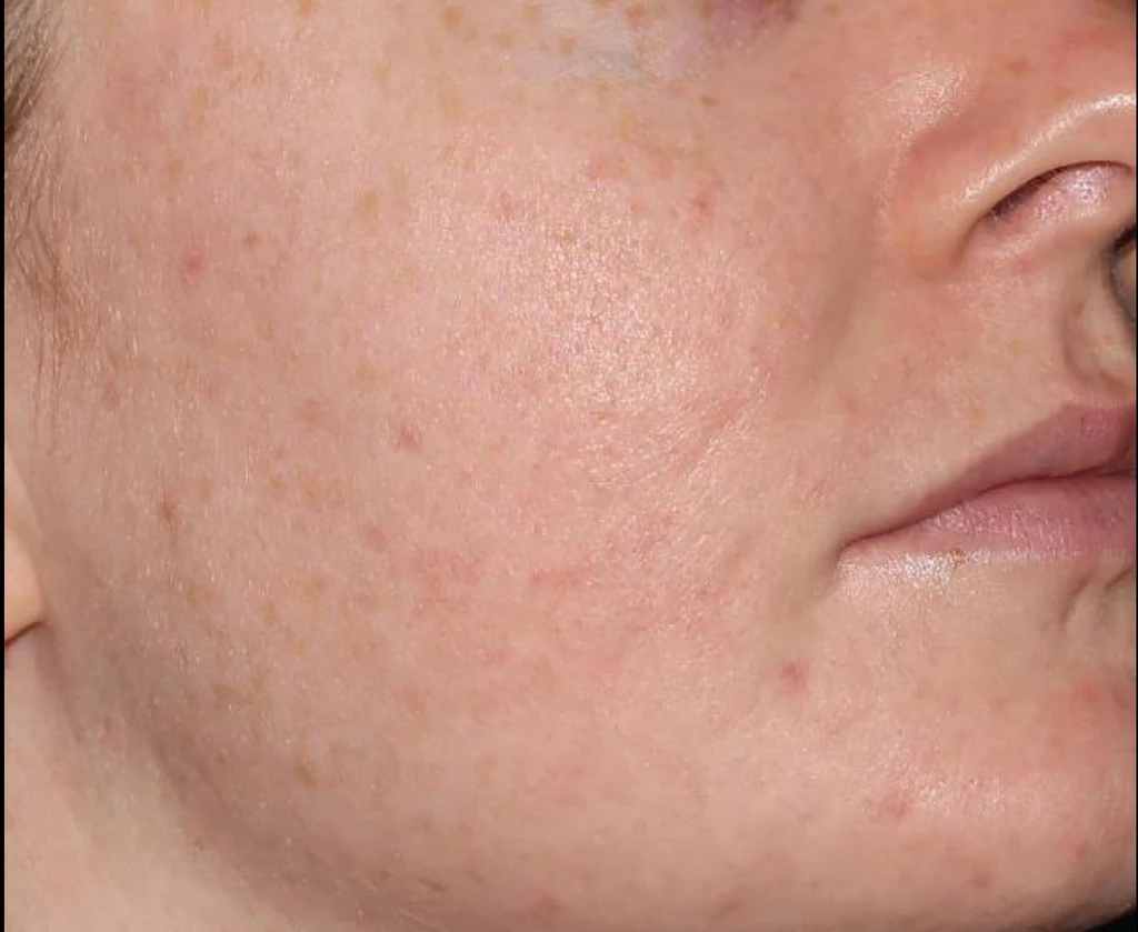 before_image