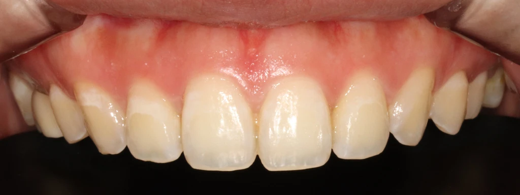 before_image