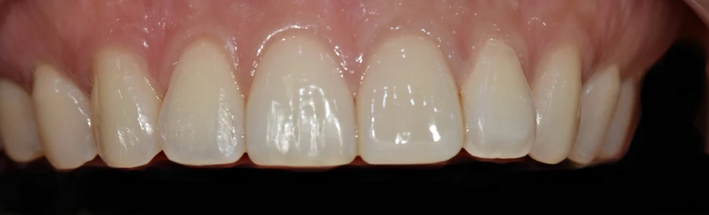 before_image