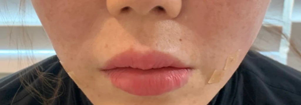 before_image