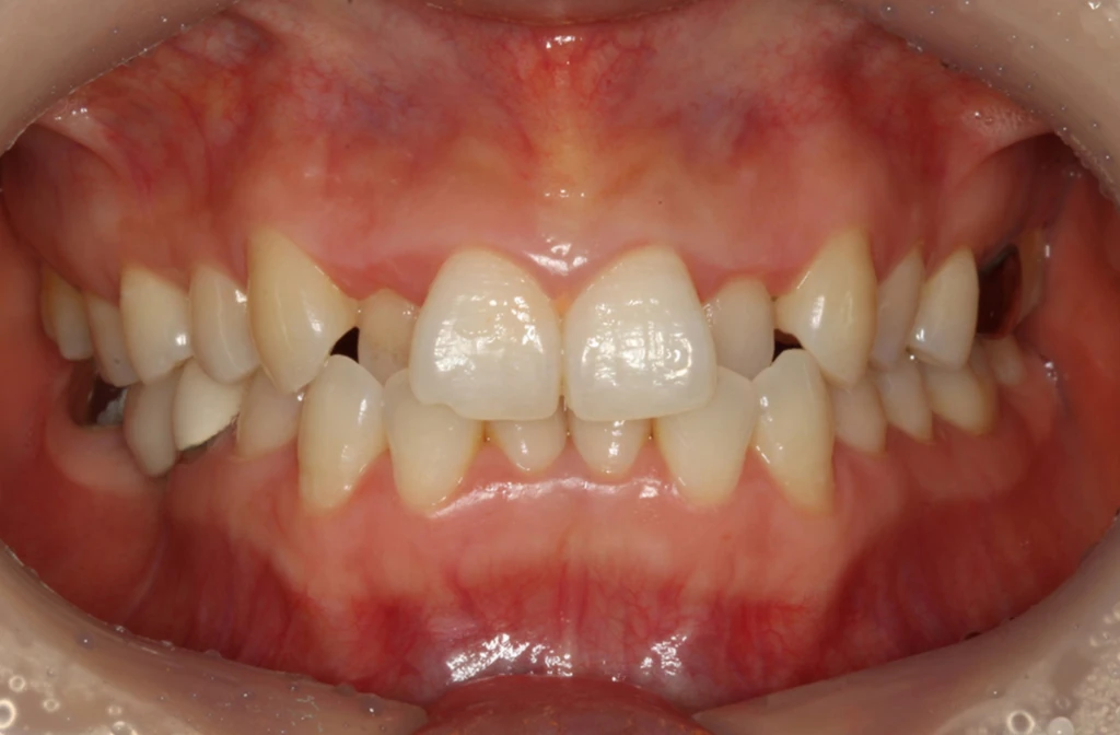 before_image