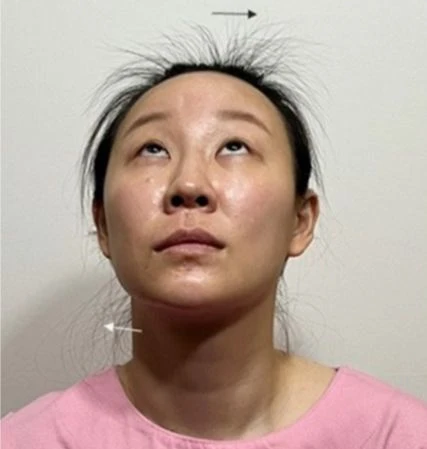 before_image