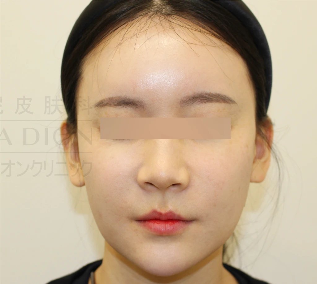 before_image