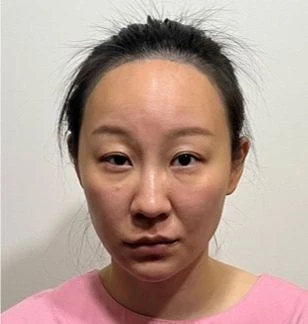 before_image