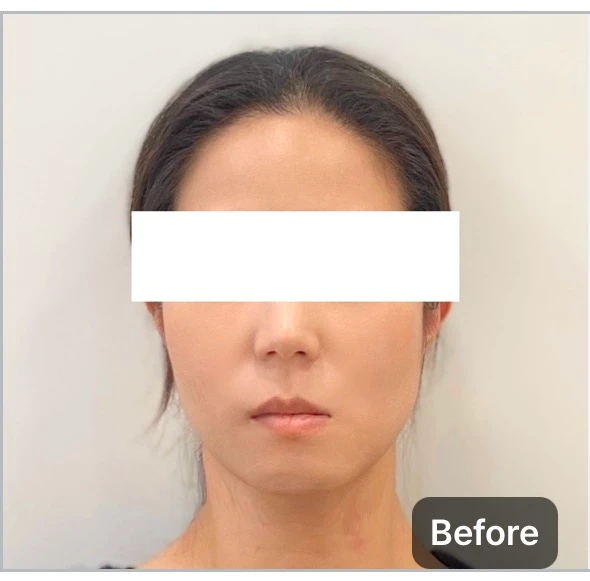 before_image