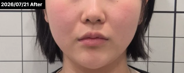 before_image