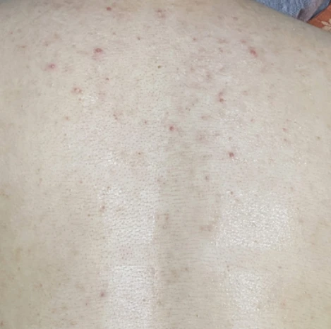 before_image