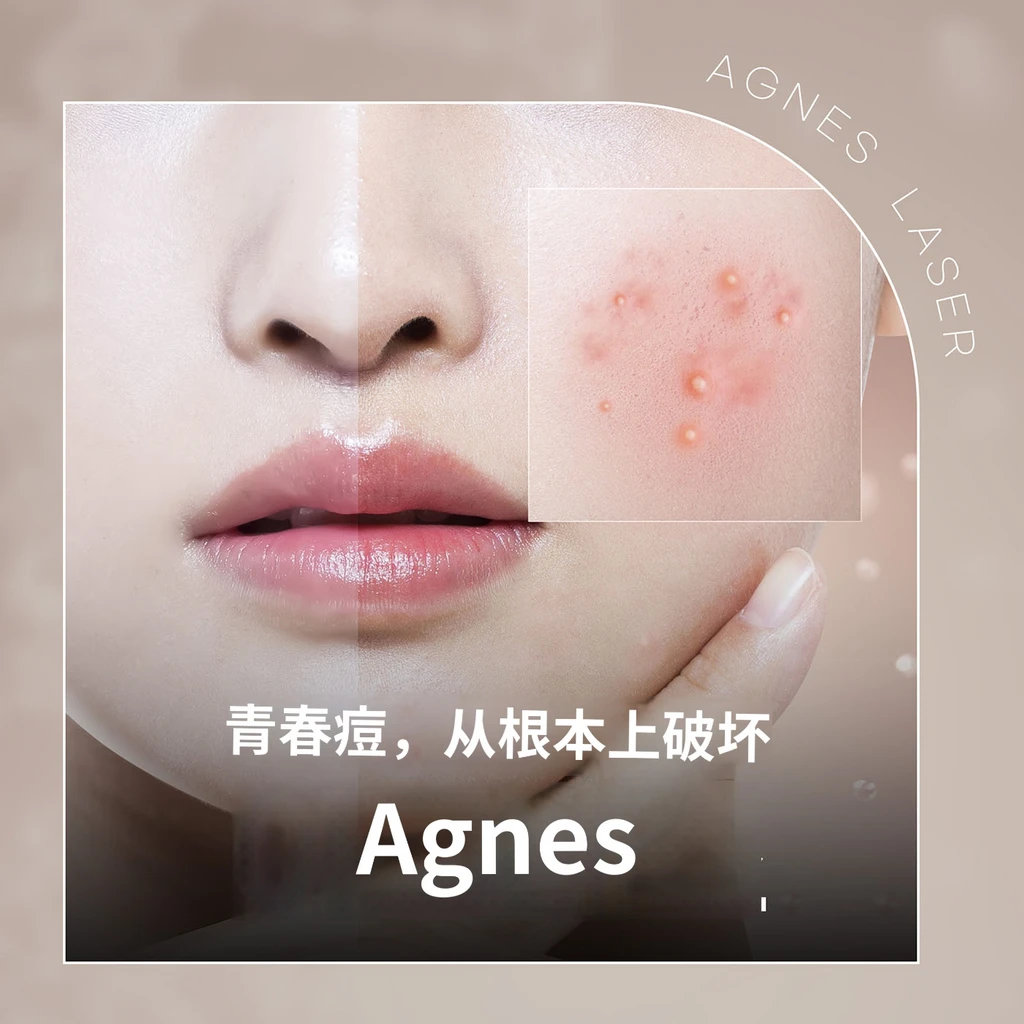 event thumbnail image