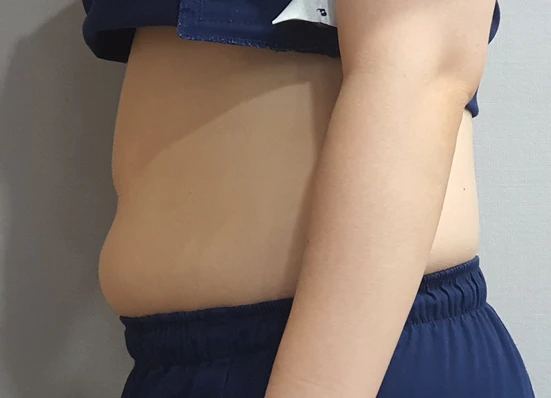 before_image