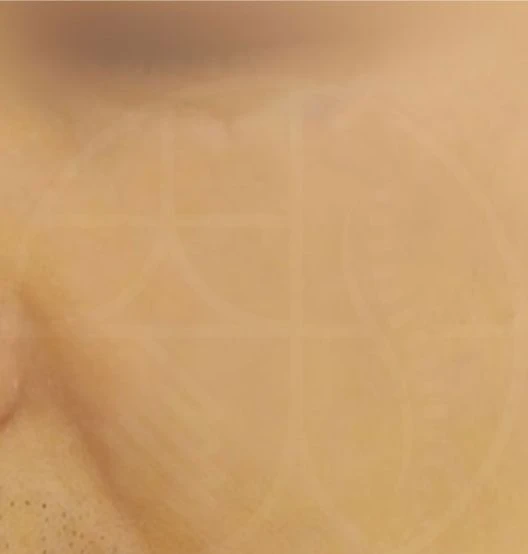 before_image