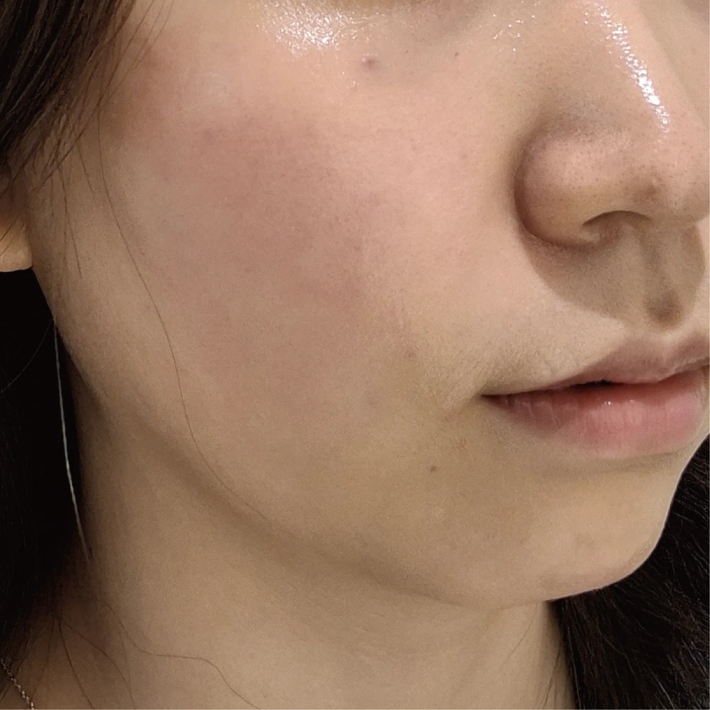 before_image