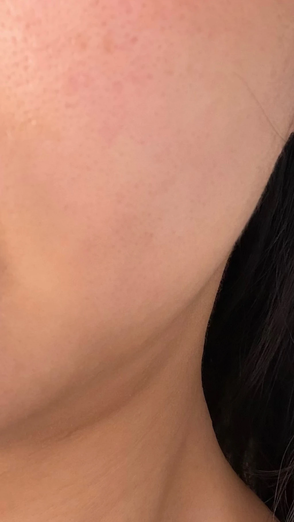 before_image